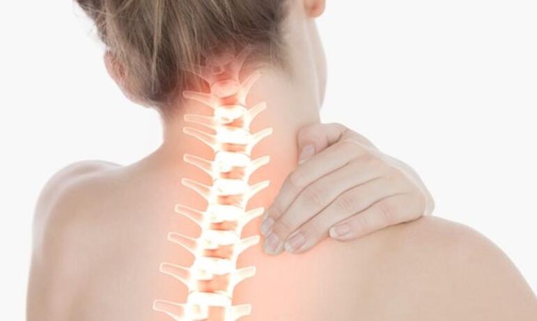 osteochondrosis an spine ceirbheacsach